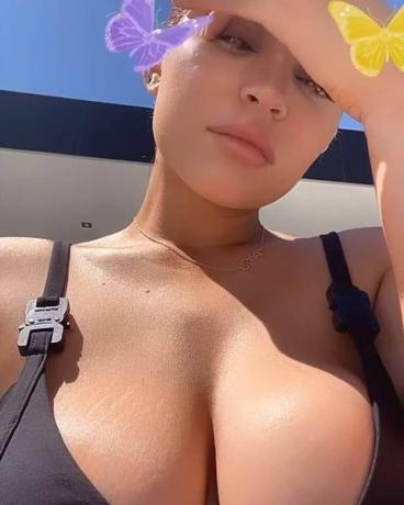 Kylie Jenner krūtis strijas