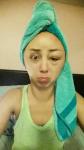 Slechte reactie op haarverf - Imgur-gebruiker plaatst foto's van gezwollen hoofd en gezicht na gebruik van haarverf
