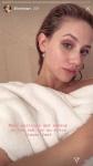 Zvezda "Riverdalea" Lili Reinhart v novem selfiju na ogled postavi brazgotine od aken