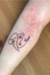 Tattoo-Ausschlag? Anzeichen für eine allergische Reaktion