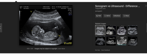 Imaging medico, Ecografia ostetrica, Radiologia, Medico, Comune, Testo, Organo, Muscolo, Corpo umano, Radiografia, 